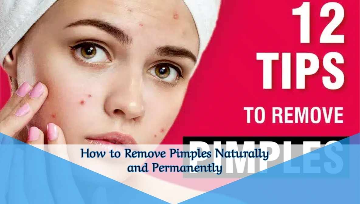 How to Remove Pimples Naturally and Permanently